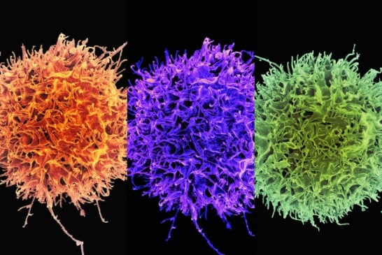 Em avanço inédito, cientistas identificam mecanismo capaz de desativar permanentemente genes ligados ao câncer